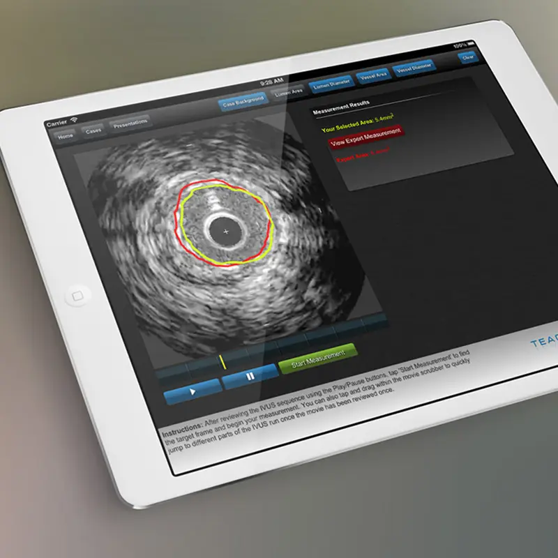 Gallery Image - An iPad with medical imaging software on screen