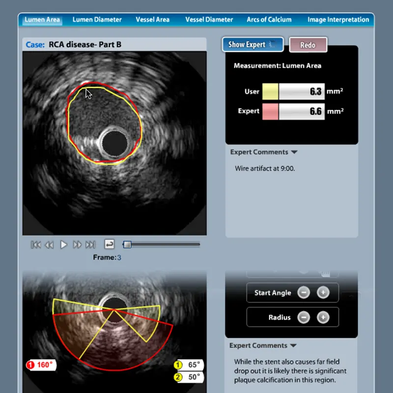 Gallery Image - Software screen showing an ultrasound medical image and UI